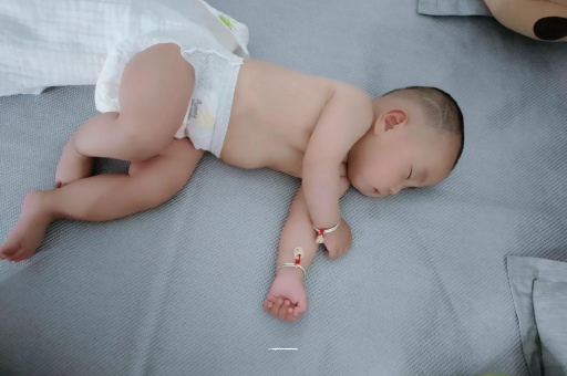 邵东宝宝头上长痱子
